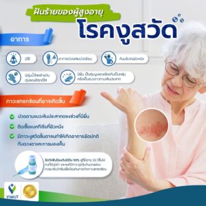 สูงวัยเสี่ยง “โรคงูสวัด” แพทย์ รพ.วิมุต เตือน ฉีดวัคซีนก่อนเกิดอาการรุนแรง-ภาวะแทรกซ้อน