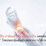 ปวดโคนนิ้วโป้ง กำมือแล้วเจ็บ อย่าชะล่าใจ แพทย์เตือนเสี่ยง “เดอกาแวง” โรคปลอกหุ้มเอ็นอักเสบจากการใช้งานซ้ำ