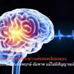 แพทย์แนะ! ตรวจอัลตราซาวนด์หลอดเลือดสมอง คัดกรองภัยเงียบอัมพฤกษ์-อัมพาต แม้ไม่มีสัญญาณเตือน