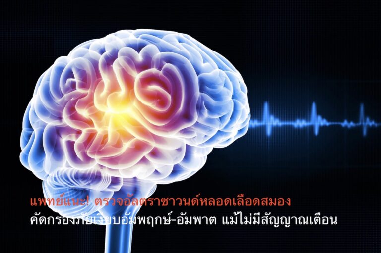 แพทย์แนะ! ตรวจอัลตราซาวนด์หลอดเลือดสมอง คัดกรองภัยเงียบอัมพฤกษ์-อัมพาต แม้ไม่มีสัญญาณเตือน