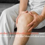 “ข้อเข่าเสื่อม” ไม่จำเป็นต้องเปลี่ยนทั้งข้อเสมอไป แพทย์ชี้ 2 ทางเลือก UKA–TKA เลือกให้เหมาะกับข้อเข่าแต่ละคน