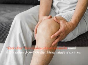 “ข้อเข่าเสื่อม” ไม่จำเป็นต้องเปลี่ยนทั้งข้อเสมอไป แพทย์ชี้ 2 ทางเลือก UKA–TKA เลือกให้เหมาะกับข้อเข่าแต่ละคน
